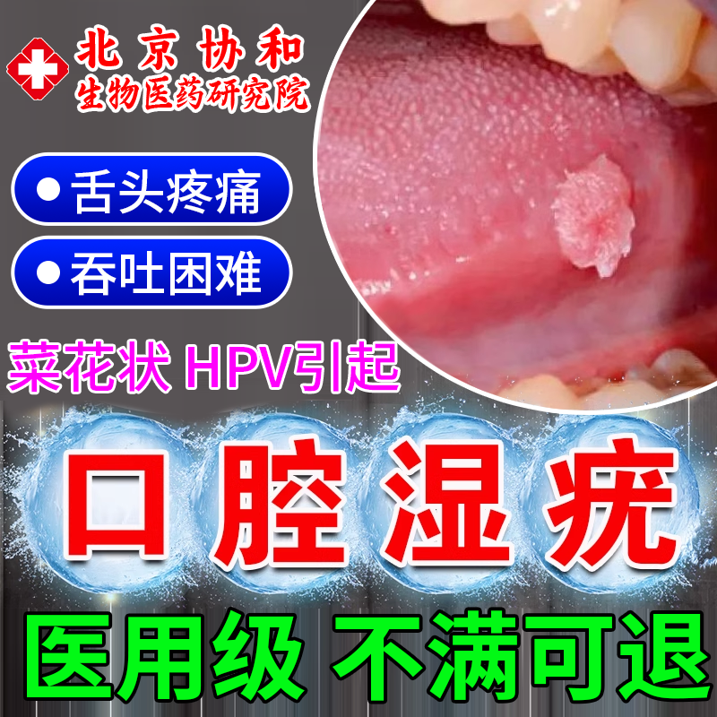 口腔尖锐湿疣专用hpv检测自检疣体舌头痛hpv病毒干扰素凝胶薬膏XL