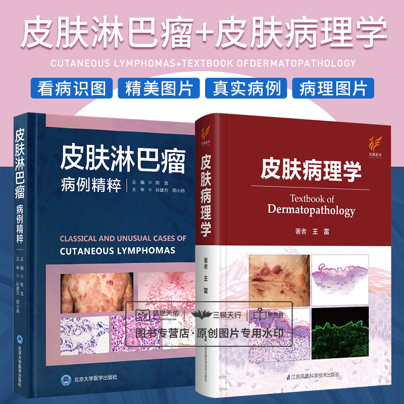 全2册 皮肤淋巴瘤病例精粹+皮肤病理学 皮肤病组织病理诊断简明图谱 原发皮肤淋巴瘤的所有类型及临床病理亚型 两本套装