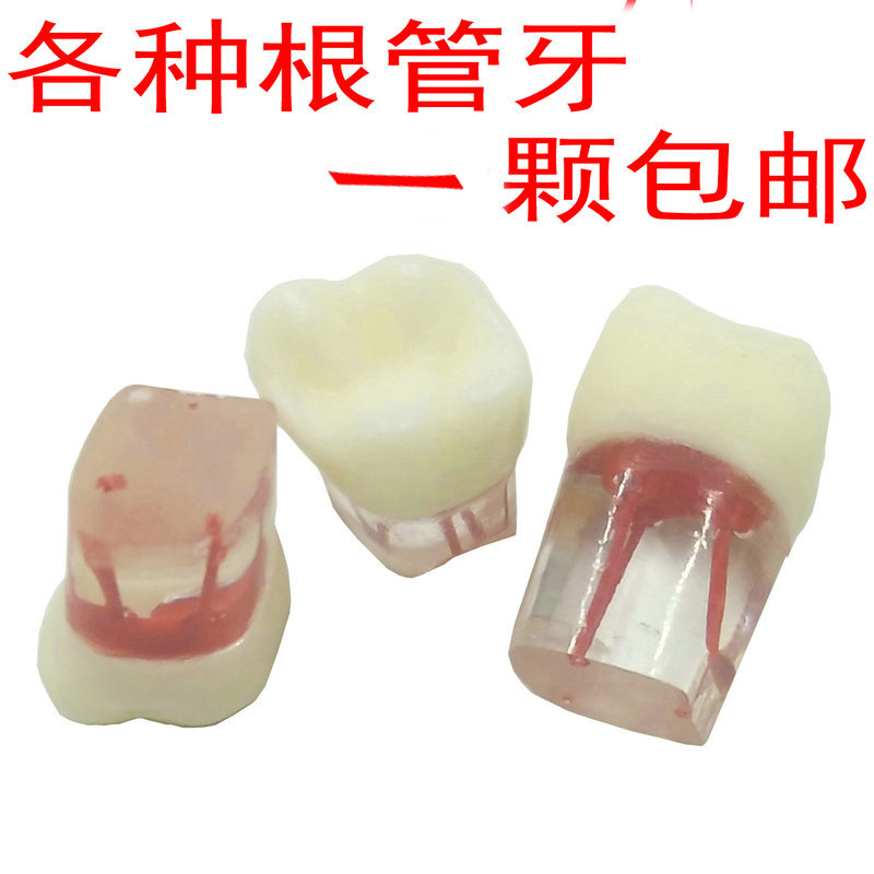 考试练习用根管牙离体牙带牙根的树脂牙模型开髓牙带髓腔骨石膏块