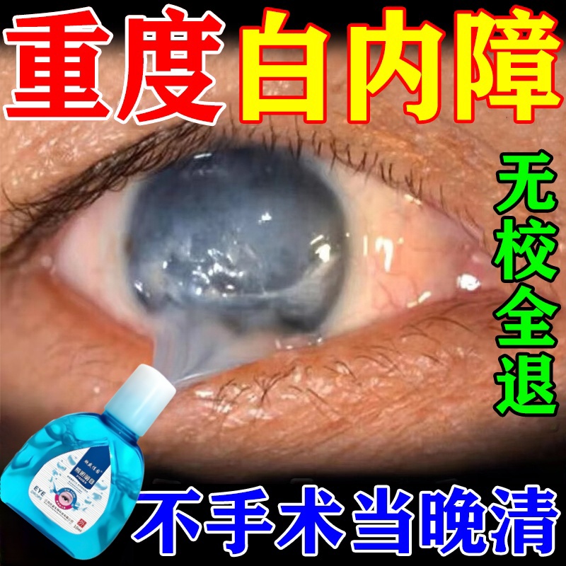 白内障专用眼药水治疗老年人视力模糊看不清白内障特效眼药滴眼液