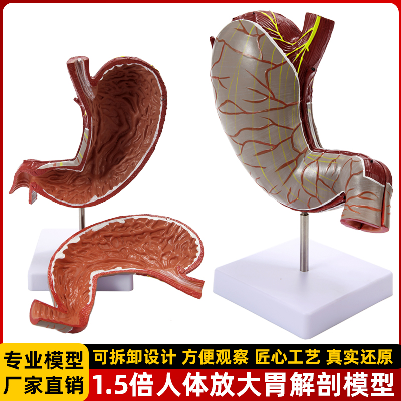 4d拼装人体正常病变胃部结构疾病演示解剖穿孔胃消化系统教学模型
