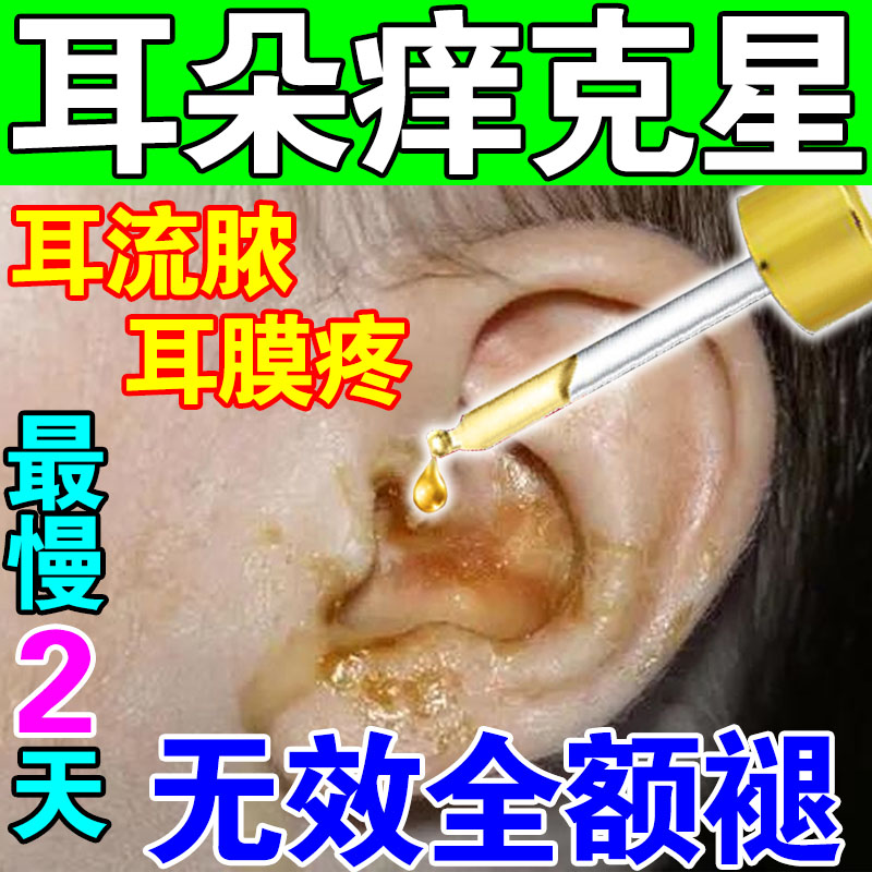 耳朵痒止痒抑菌耳朵消炎中耳炎专用药耳朵疼外耳道流脓水滴耳液