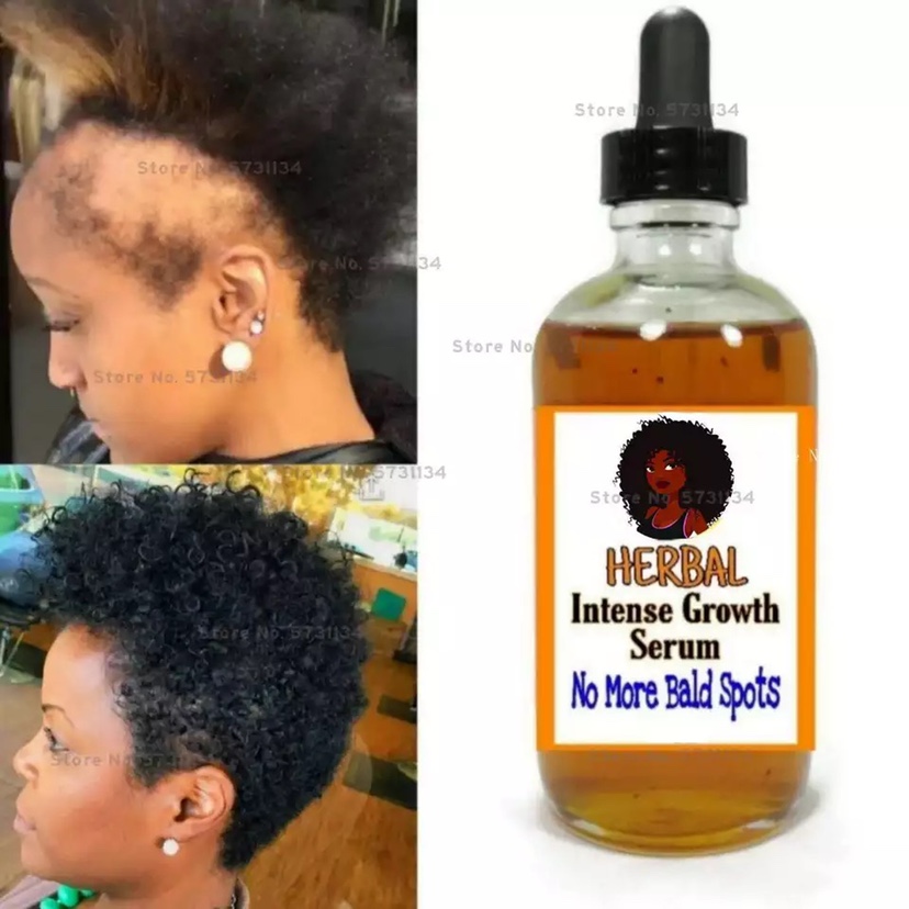 Black Seed Castor Oil Hair Growth Serum Thick Fast Growth