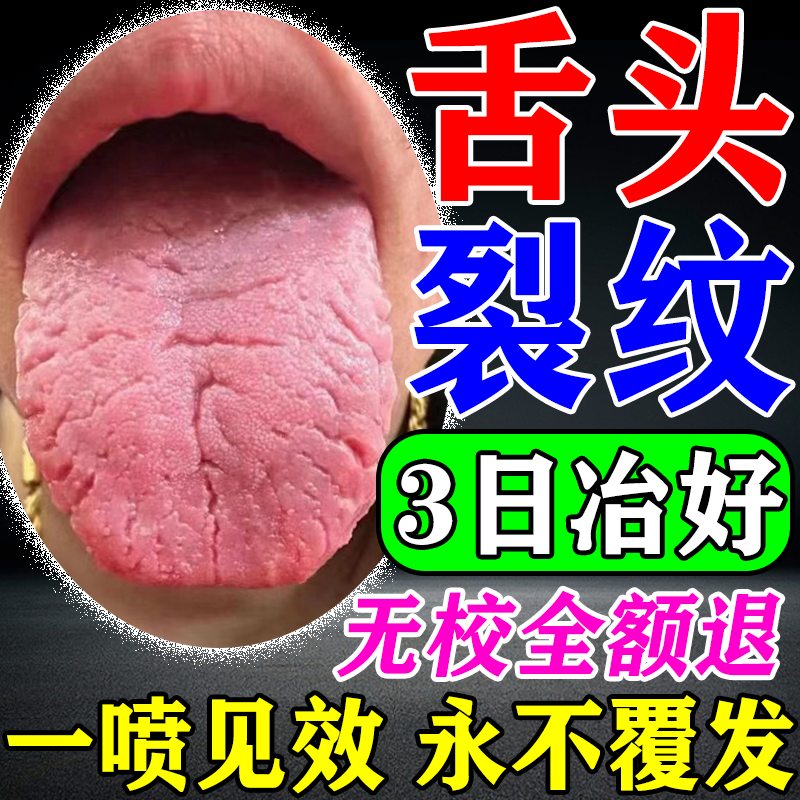 舌头中间有裂纹齿痕地图舌调理口臭舌苔发白厚肥大灼口综合征的药