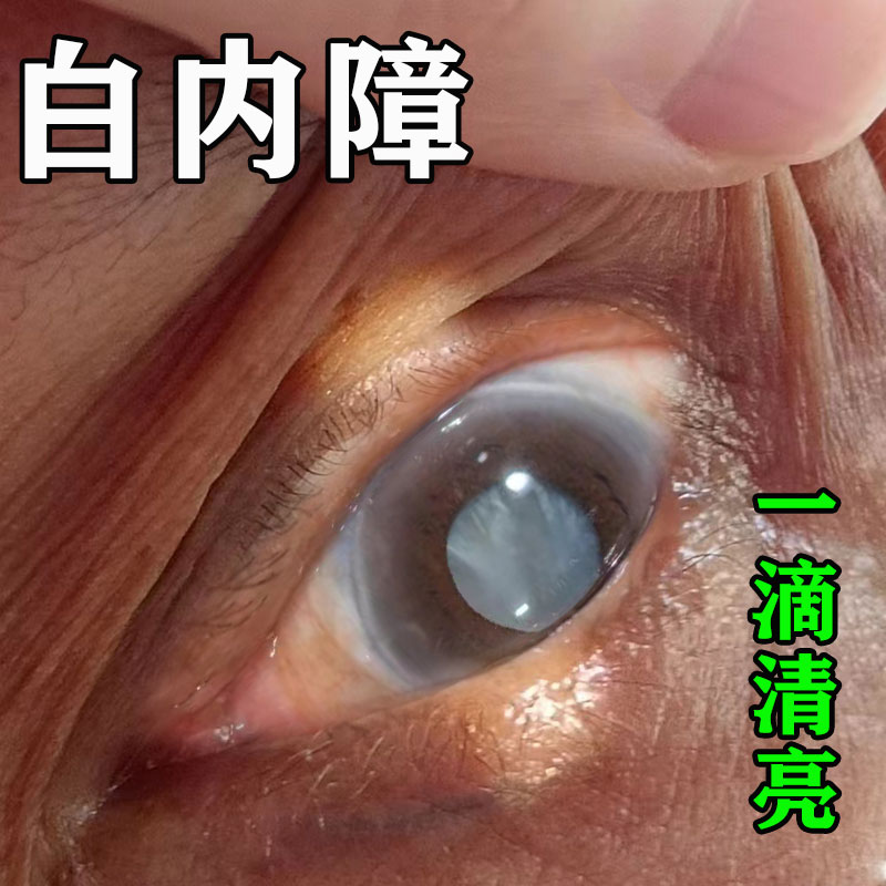 白内障专用特校眼药水治疗老年人视力模糊看不清叶黄素滴眼液