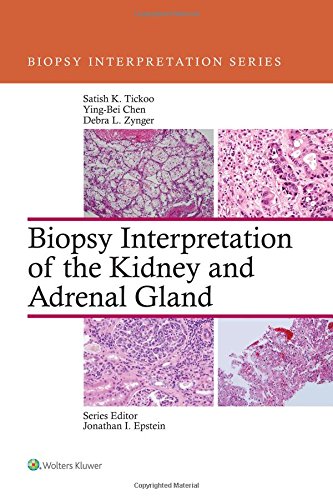 【预订】Biopsy Interpretation of the Kidney & Adrenal Gland