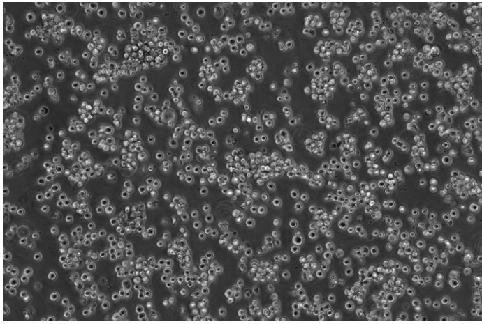 海星Hepatoma-22细胞 H22细胞 TCM-C788 淋巴母细胞样 悬浮生长