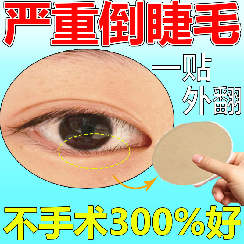 倒睫毛矫正贴神器日本儿童成人上眼睑下垂外翻提拉下睫毛眼贴专用