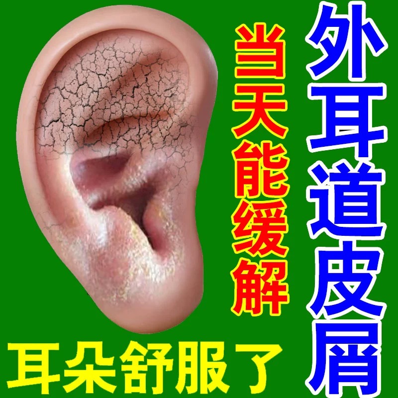 治疗耳朵痒的药耳部化脓性流水外耳道起皮屑银屑病真菌感染止痒膏