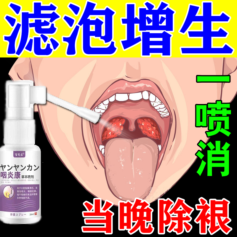 舌根淋巴滤泡增生咽炎慢性咽炎除 根喷剂嗓子干痒疼痛扁桃体肿大