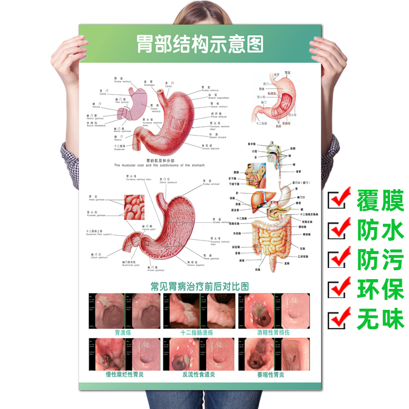 胃部结构系统示意图医学宣传挂图人体器官解剖图医院肠胃疾病海报