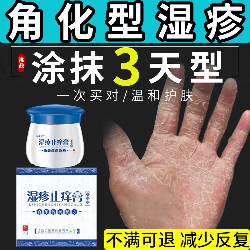 角化型湿疹手癣膏脱皮干裂真菌感染手足癣膏湿疹止痒kj