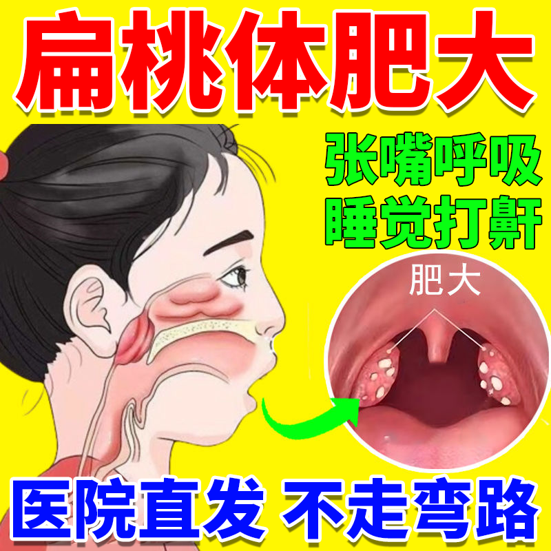 儿童喉咙化脓