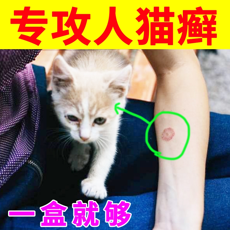 猫癣人用药治疗人患猫癣药真菌感染得了猫狗癣皮肤冰外用癣药膏
