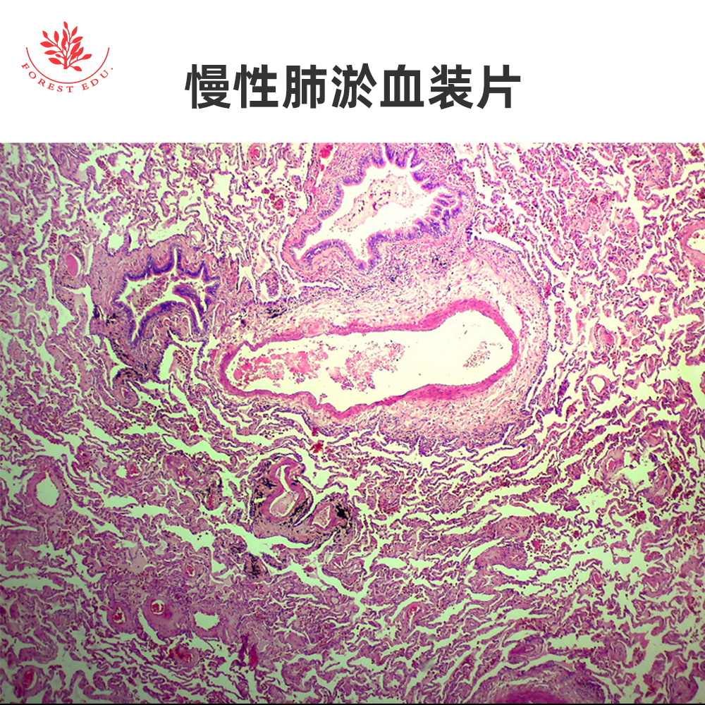 慢性肺淤血切片慢性肝淤血切片高教品质医学教学研究用显微镜玻片