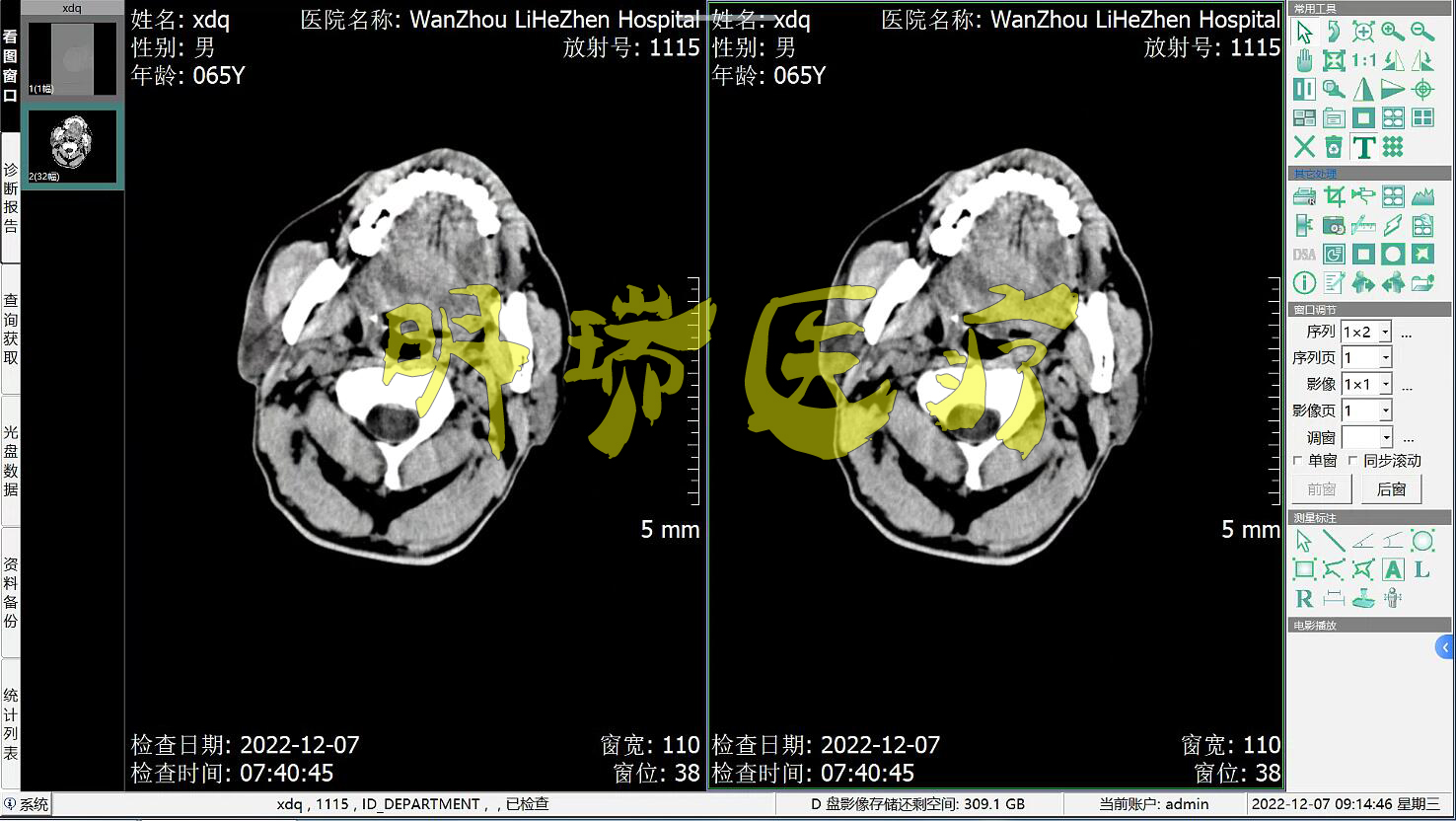 CT工作站软件CT报告软件DR工作站软件CR工作站软件MRI核磁软件