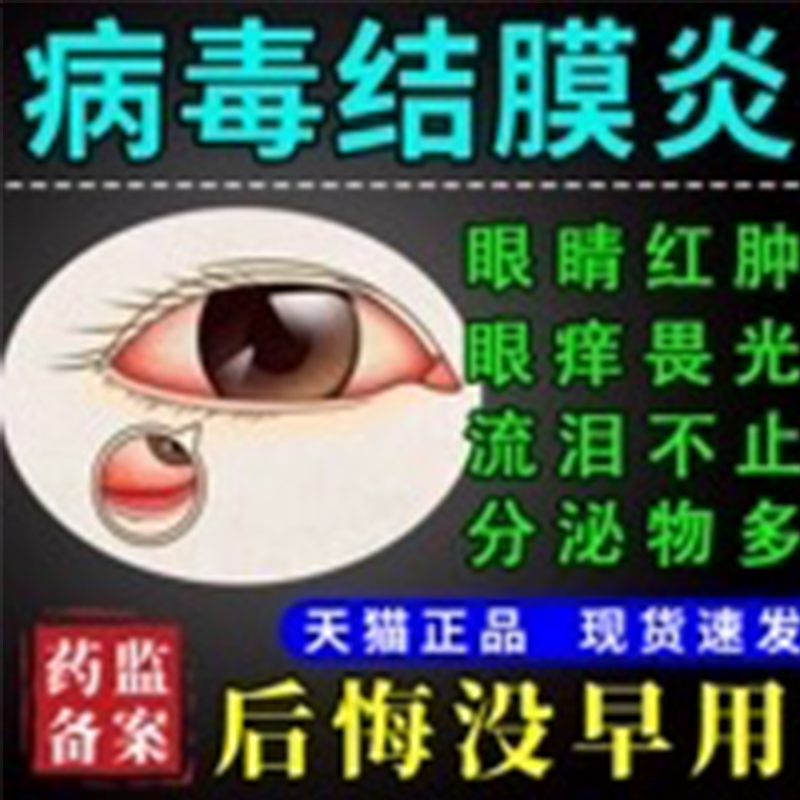 艾氟龙氟米龙滴眼液眼睑炎结膜炎角膜炎表层巩膜炎虹膜炎葡萄膜炎