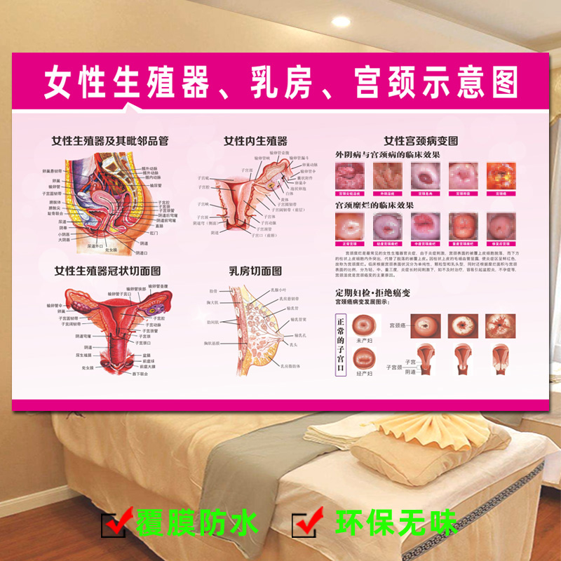 医院妇科宫颈疾病示意图挂图海报子宫女性生殖器系统解剖图宣传画