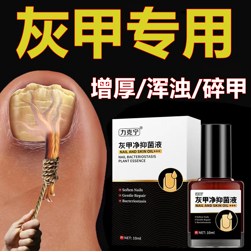 灰指甲专用液 --专用手指甲脚趾有竖纹甲净亮灰甲温和脱甲抑菌液