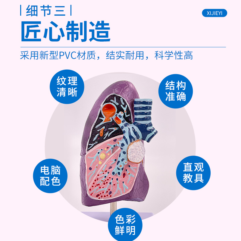 病变肺模型 病理肺解剖 吸烟者内脏 病态肺部切面 呼吸系统模型