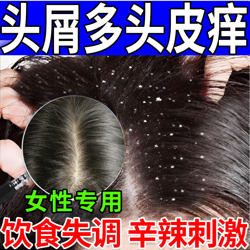 头皮屑脂溢性皮炎真菌感染头癣洗发水儿童去屑止痒头部喷剂头癣LG