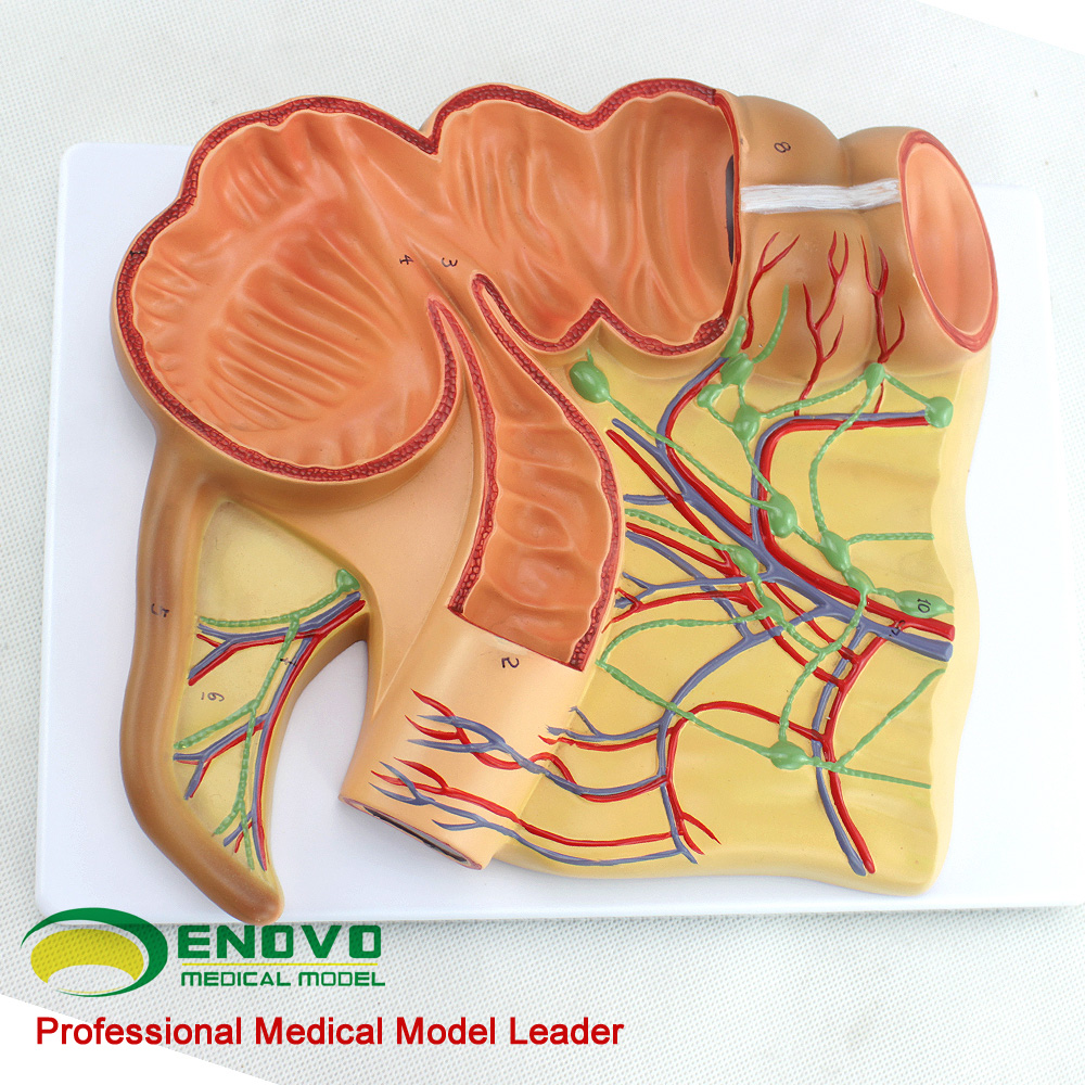 ENOVO颐诺 人体医学回盲部解剖模型 盲肠 阑尾升结回肠血管淋巴模