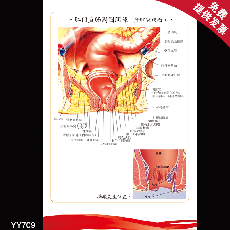 医院人体解剖知识挂画人体结构挂图 肛门直肠周围间隙盆腔冠状面