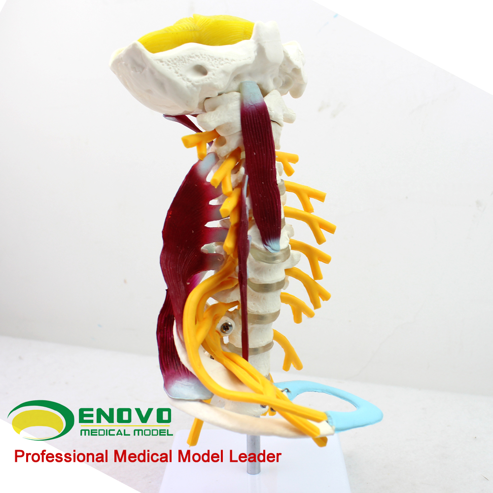 ENOVO颐诺医学人体颈椎模型颈臂丛神经肌肉模型 人体骨骼标本模型寰枢关节疼痛科颈部肌颈肩骨科教学医生医院