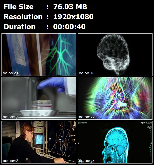 欧盟委员会会议欧洲人脑计划科学研究项目脑活动全图高清实拍视频